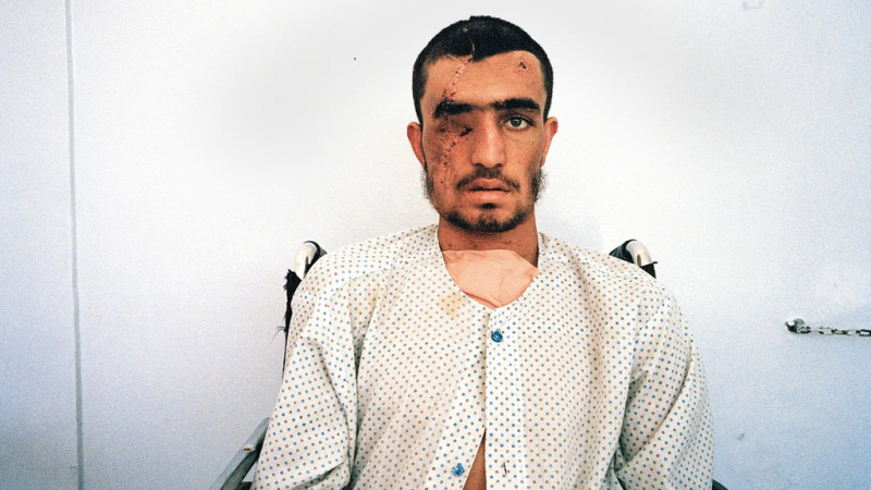 Мохаммад в больнице Кабула, Афганистан. Ему выстрелили в голову.