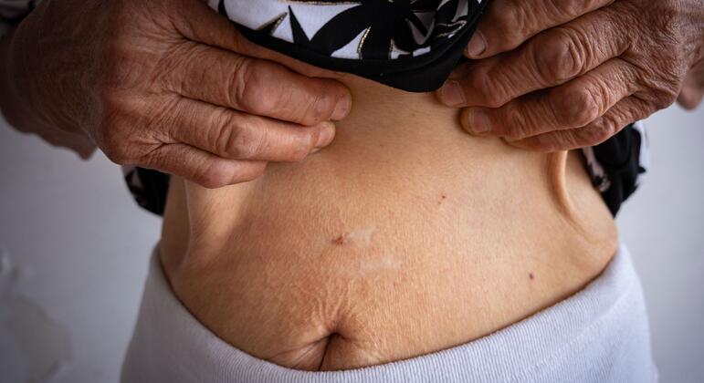 Украинка, пережившая насилие в ходе войны: &laquo;Эта травма останется со мной на всю жизнь&raquo;